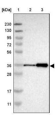 Western Blot: ZNF346 Antibody [NBP1-83084]