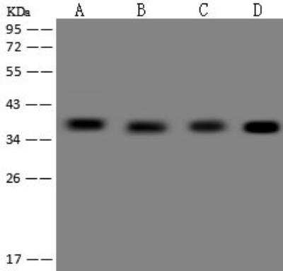 Western Blot: ZNF346 Antibody [NBP3-12616]