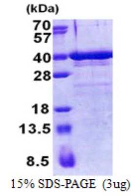 SDS-PAGE: Recombinant Human ZNF346 His Protein [NBP2-22956]