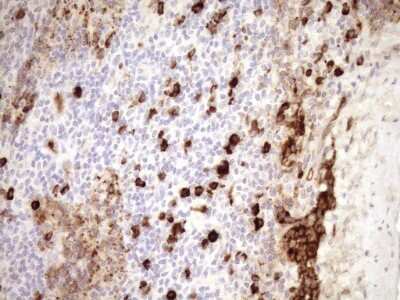 Immunohistochemistry: ZNF35 Antibody (OTI4D5) [NBP2-46434]