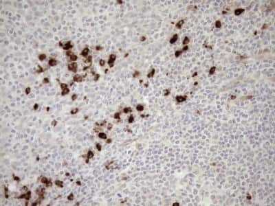 Immunohistochemistry: ZNF35 Antibody (OTI4D5) [NBP2-46434]