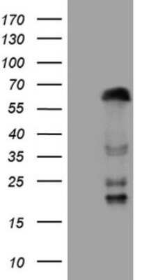 Western Blot: ZNF35 Antibody (OTI4D5) [NBP2-46434]