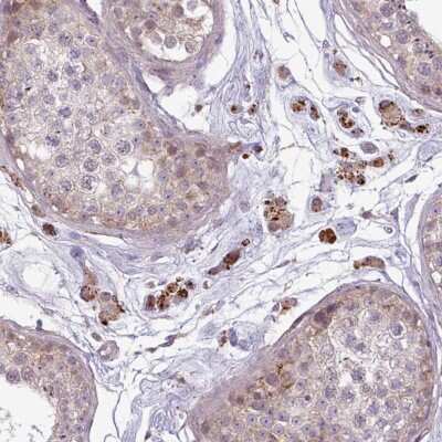 Immunohistochemistry-Paraffin: ZNF35 Antibody [NBP2-30820]