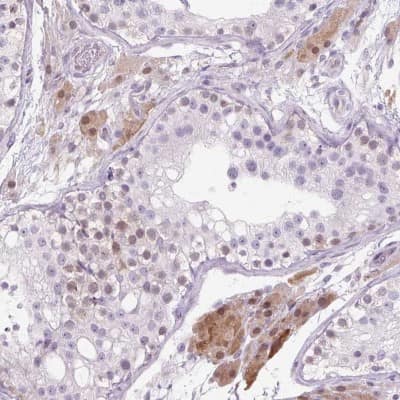 Immunohistochemistry-Paraffin: ZNF35 Antibody [NBP2-30842]