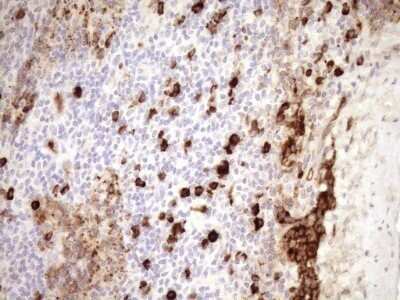 Immunohistochemistry: ZNF35 Antibody (OTI4D5) - Azide and BSA Free [NBP2-74938]