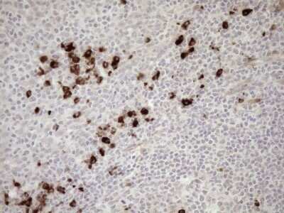 Immunohistochemistry: ZNF35 Antibody (OTI4D5) - Azide and BSA Free [NBP2-74938]