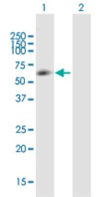 Western Blot: ZNF35 Antibody [H00007584-B01P]