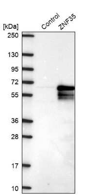 Western Blot: ZNF35 Antibody [NBP2-30820]