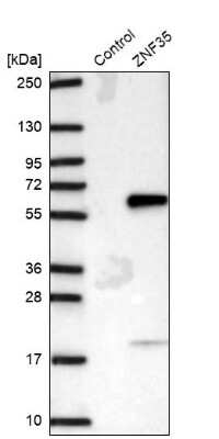 Western Blot: ZNF35 Antibody [NBP2-30842]