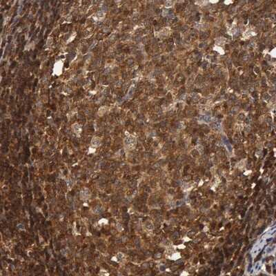Immunohistochemistry-Paraffin: ZNF350 Antibody [NBP1-80608]