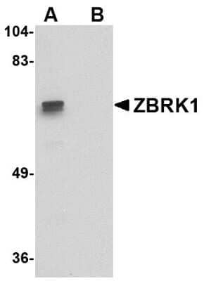 Western Blot: ZNF350 AntibodyBSA Free [NBP1-76344]