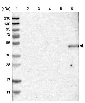 Western Blot: ZNF350 Antibody [NBP1-80608]