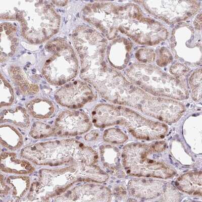 Immunohistochemistry-Paraffin: ZNF354A Antibody [NBP2-13568]