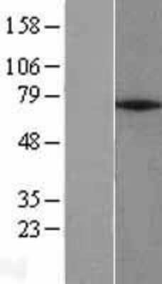 Western Blot: ZNF354A Overexpression Lysate [NBL1-18130]