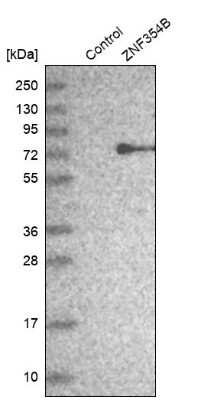 Western Blot: ZNF354B Antibody [NBP1-82064]