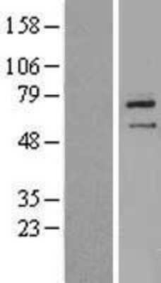 Western Blot: ZNF354B Overexpression Lysate [NBL1-18131]