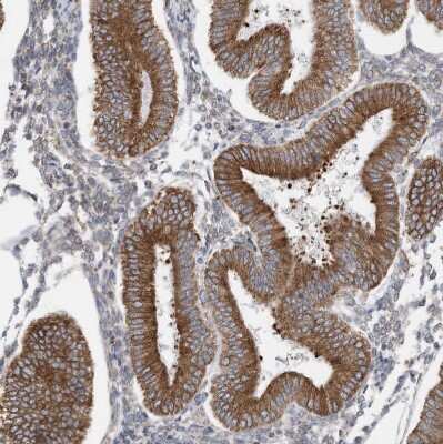 Immunohistochemistry-Paraffin: ZNF354C Antibody [NBP1-81352]