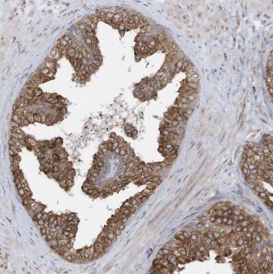 Immunohistochemistry-Paraffin: ZNF354C Antibody [NBP1-81352]
