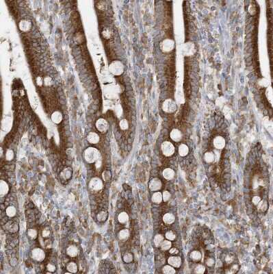 Immunohistochemistry-Paraffin: ZNF354C Antibody [NBP1-81352]