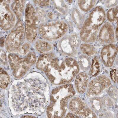 Immunohistochemistry-Paraffin: ZNF354C Antibody [NBP1-81352]