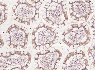 Immunohistochemistry-Paraffin: ZNF354C Antibody [NBP3-06035]