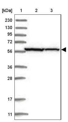 Western Blot: ZNF354C Antibody [NBP1-81352]