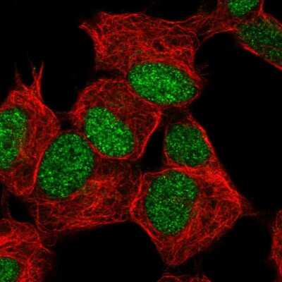 Immunocytochemistry/ Immunofluorescence: ZNF358 Antibody [NBP2-57435]