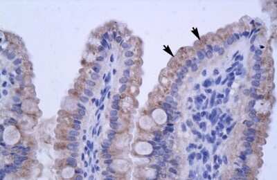 Immunohistochemistry: ZNF358 Antibody [NBP2-88678]