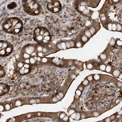 Immunohistochemistry-Paraffin: ZNF358 Antibody [NBP1-83861]