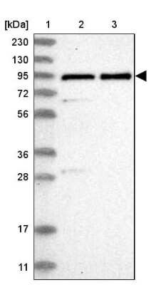 Western Blot: ZNF358 Antibody [NBP1-83861]