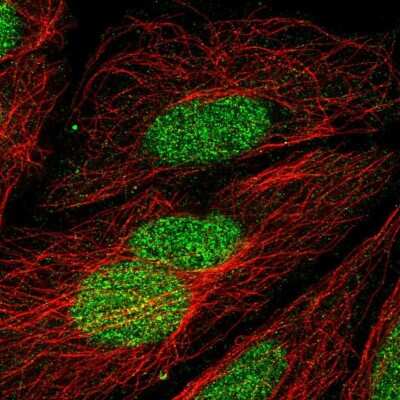 Immunocytochemistry/ Immunofluorescence: ZNF362 Antibody [NBP2-31756]