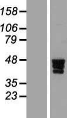 Western Blot: ZNF362 Overexpression Lysate [NBL1-18133]