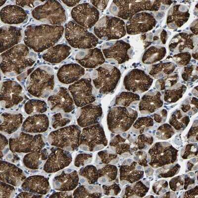 Immunohistochemistry-Paraffin: ZNF364 Antibody [NBP1-85586]