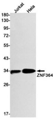 Western Blot: ZNF364 Antibody (S06-1B3) [NBP3-19489]