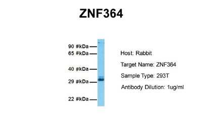 Western Blot: ZNF364 Antibody [NBP1-55055]