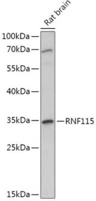 Western Blot: ZNF364 AntibodyAzide and BSA Free [NBP2-94360]