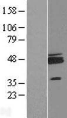 Western Blot: ZNF364 Overexpression Lysate [NBL1-15414]