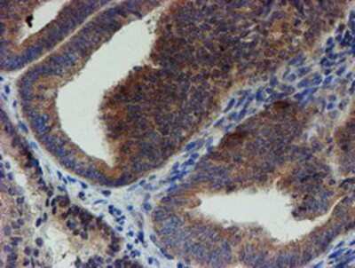 Immunohistochemistry-Paraffin: ZNF365 Antibody (OTI1B7) [NBP2-03848]