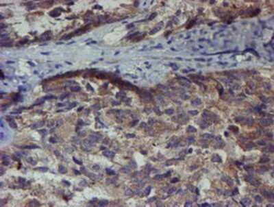 Immunohistochemistry-Paraffin: ZNF365 Antibody (OTI1B7) [NBP2-03848]