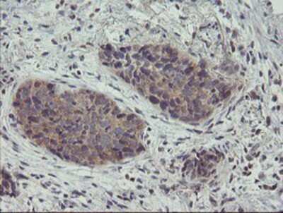 Immunohistochemistry-Paraffin: ZNF365 Antibody (OTI1B7) [NBP2-03848]