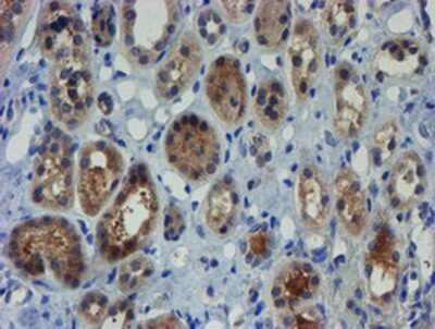 Immunohistochemistry-Paraffin: ZNF365 Antibody (OTI1B7) [NBP2-03848]