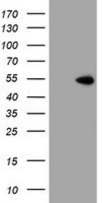 Western Blot: ZNF365 Antibody (OTI1B7) [NBP2-03848]