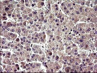 Immunohistochemistry: ZNF365 Antibody (OTI9H5) [NBP2-46444]