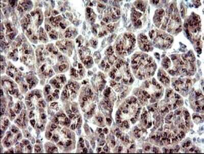 Immunohistochemistry: ZNF365 Antibody (OTI9H5) [NBP2-46444]