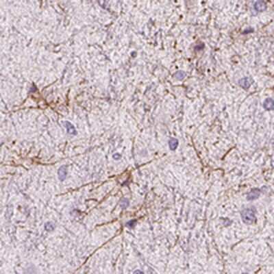 Immunohistochemistry-Paraffin: ZNF365 Antibody [NBP2-30451]