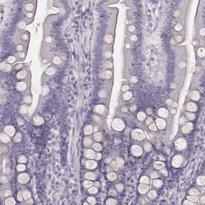 Immunohistochemistry-Paraffin: ZNF365 Antibody [NBP2-30451]