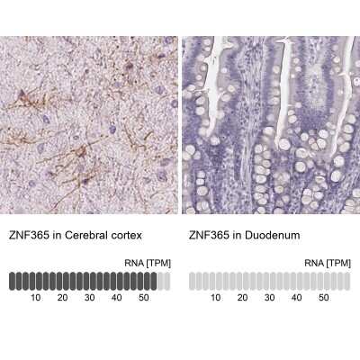 Immunohistochemistry-Paraffin: ZNF365 Antibody [NBP2-30451]