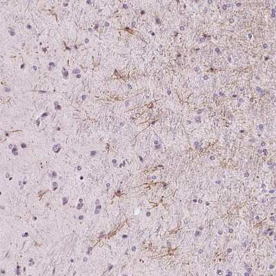 Immunohistochemistry-Paraffin: ZNF365 Antibody [NBP2-30451]