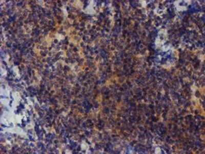 Immunohistochemistry: ZNF365 Antibody (OTI1B7) - Azide and BSA Free [NBP2-74945]