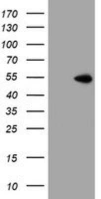 Western Blot: ZNF365 Antibody (OTI1B7)Azide and BSA Free [NBP2-74945]